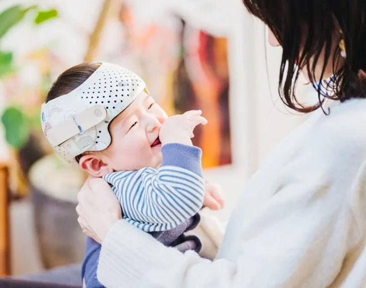 赤ちゃんヘルメット外来